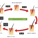 育毛剤の評価と選び方と薄毛のメカニズム